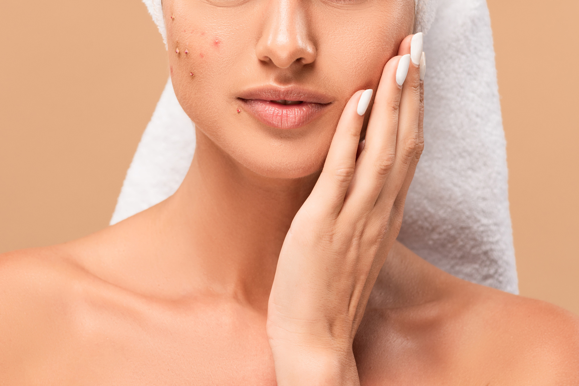ニキビの悩み | 福岡県北九州のエステならBella